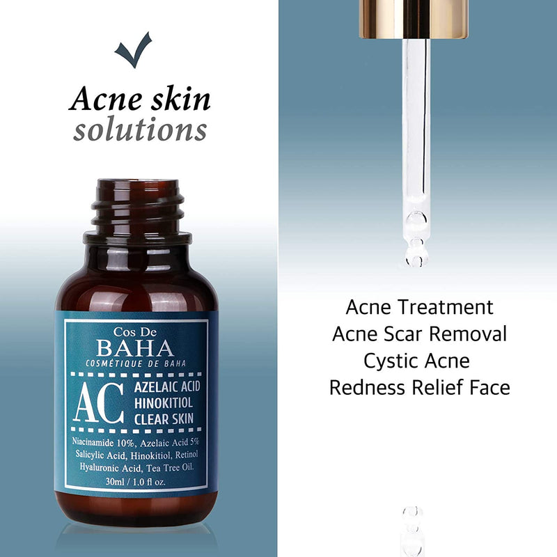 Alcohol Free Acne Treatment Intensive Facial Serum with Azelaic acid 5%, Niacinamide 10%, Salicylic Acid, Retinol, Tea Tree - Fast & Efficient Cystic Acne, Age-Defying Formula 1oz (30ml)